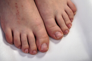 Pedicure on female feet close-up. Procedures in a beauty salon.