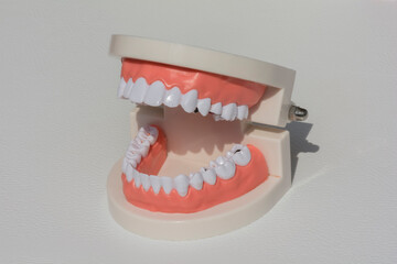 medical model of human teeth made of plastic with black dots imitating caries
