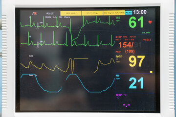 Ekg machine in hospital emergency room used for heart attack diagnosis