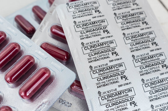 Philippines - May 2022: Blister packs of Clindamycin Hydrochloride capsules. 300 mg antibacterial treatment. Medicine for sale at a drugstore or pharmacy.