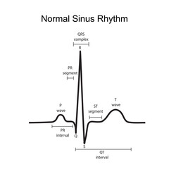 Electrocardiogram show normal heart beat line (Sinus rhythm). ECG. EKG. Vital sign. Medical healthcare symbol.
