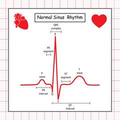 Electrocardiogram show normal heart beat line (Sinus rhythm). ECG. EKG. Vital sign. Medical healthcare symbol.