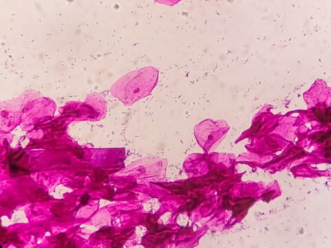 bacteria Gram staining under microscope