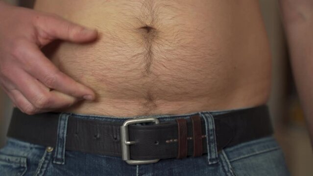 Man hand touches big creases on plump belly with appendicitis scar above jeans extreme closeup. Man concerns about overweight. Male bare belly