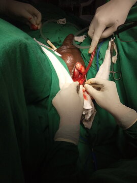 testis surgery