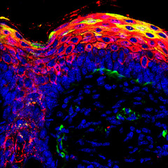 Mouse skin. Immunostaining keratin 6 and keratin 10. Capture: Confocal microscopy.
