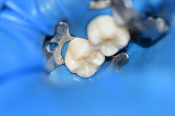 dentist with tools and teeth