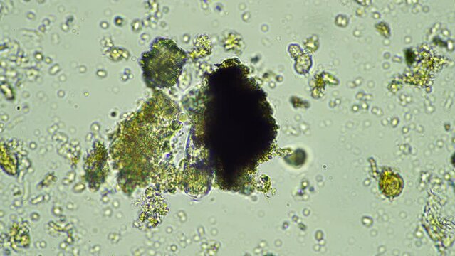 microorganisms and soil biology, with nematodes and fungi under the microscope. in a soil and compost