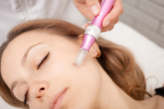 Mesotherapy in salon, cosmetologist, microneedles for rejuvenation and elimination of shortcomings.