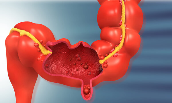 Colon anatomy medical concept. 3d illustration.
