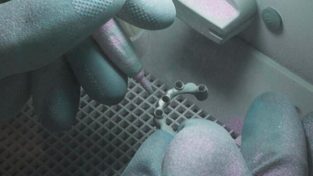 Close-up of metal teeth production process at the dental clinic. Cleaning the produced metal parts of the teeth replacements. Removing the dirt from the produced metal teeth bridge with a sandblaster