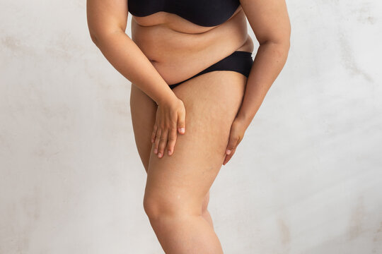 Unrecognizable overweight woman with sag hips, obesity, excess fat in lingerie on white isolated background. Squeezing cellulite thigh. Gaining weight after childbirth flabs, overeating problems