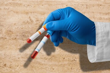 Blood sample for Genetic test, known as mutations,