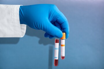 Blood sample for Genetic test, known as mutations,