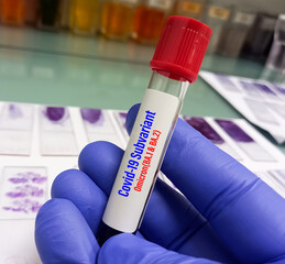 Blood sample for Covid-19 Subvariant omicron (BA.1 and BA.2) test, laboratory background.