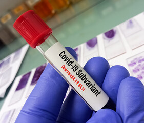 Blood sample for Covid-19 Subvariant omicron (BA.5 and BA.5) test, laboratory background.
