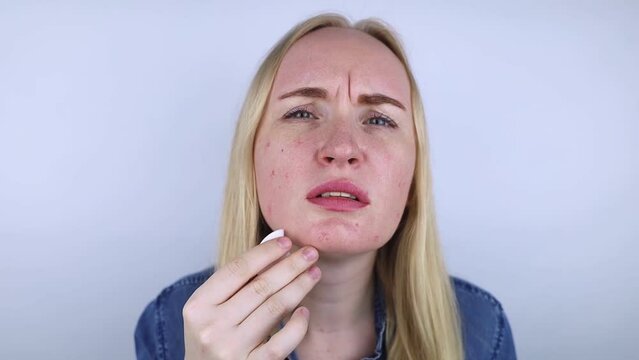 Allergy to cosmetics. Girl got acne from a poor-quality cream, powder or foundation. Concept of skin reaction to substandard or toxic products.