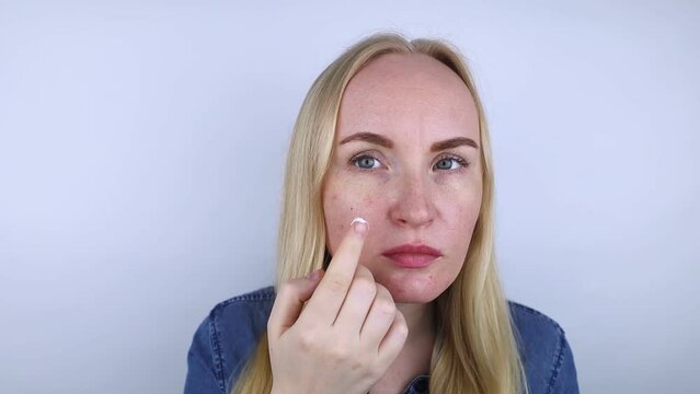Allergy to cosmetics. Girl got acne from a poor-quality cream, powder or foundation. Concept of skin reaction to substandard or toxic products.