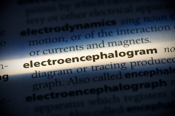 electroencephalogram