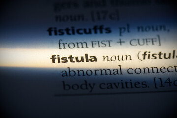 fistula