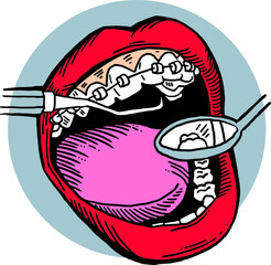 Braces on the teeth. Medical dentist checkup in dental clinic. Tooth correction with brackets. Open mouth showing healthy teeth and gums. Hand drawn vintage vector illustration. Old style drawing.