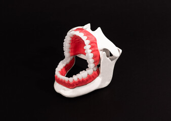 Human jaw with teeth and gums anatomy model isolated on black background. Opened jaw position. Healthy teeth, dental care, and orthodontic medical healthcare concept.