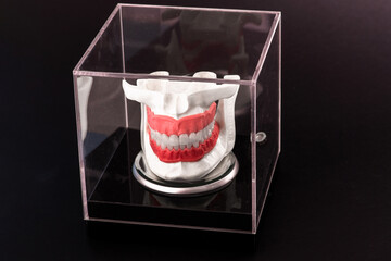 Human jaw with teeth implants anatomy model isolated on black background in a glass box.
