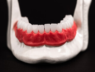 Lower human jaw with teeth and gums anatomy model isolated on blue background. Healthy teeth, dental care and orthodontic medical healthcare concept. 