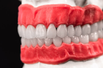 Human jaw with teeth and gums anatomy model isolated on blue background. Healthy teeth, dental care and orthodontic medical healthcare concept