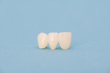 Metal free ceramic teeth implant dental crowns isolated on a blue background. 