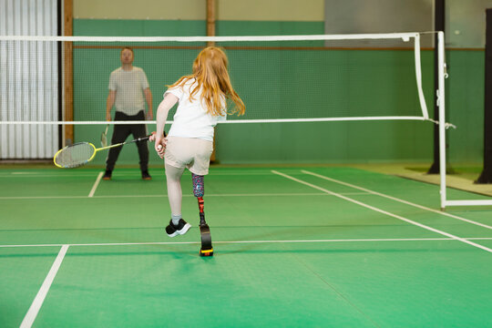 Girl with artificial leg playing badminton
