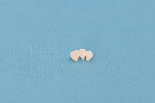 Metal free ceramic teeth implant dental crowns isolated on a blue background. 