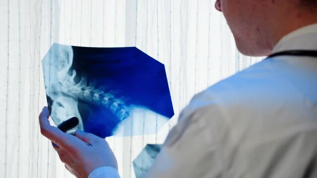 Doctor examining neck x-ray close-up. Magnetic Resonance Image of Spinal Column, Skull Head. Man therapist looking at xray of spine bones. Healthcare and medicine concept.