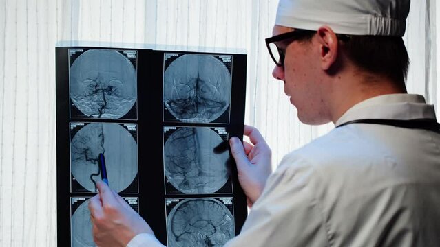 Doctor examining X-ray,brain MRI. Magnetic resonance image of head. Therapist man looking at human blood vessels close-up. Advanced research of body, checkup tomography. 