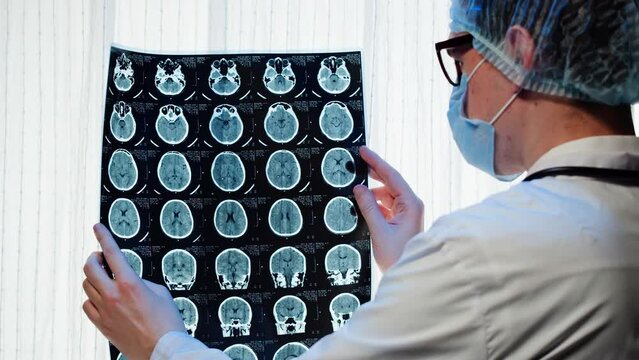 Doctor examining X-ray, Magnetic resonance image of head. Man nurse looking at human brain MRI close-up. Advanced research of body, checkup tomography. 