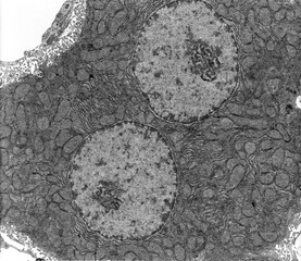 Liver. Hepatocyte. TEM micrograph - obrazy, fototapety, plakaty