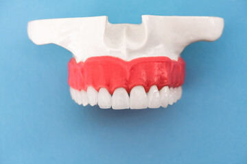 Teeth implant and crown installation process parts isolated on a blue background. Medically accurate 3D model. 