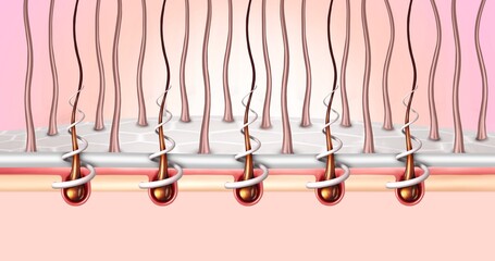 Illustration of how a scalp mask works. 3d rendering. Exfoliation of dead particles.