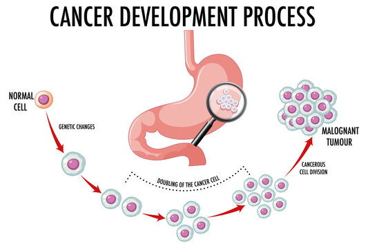 Diagram showing cancer development process