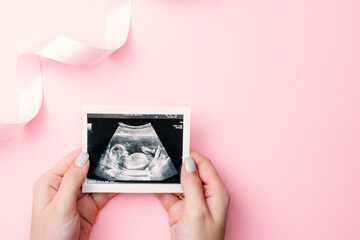 Ultrasound photo pregnancy baby. Woman hands holding ultrasound pregnant picture on pink...