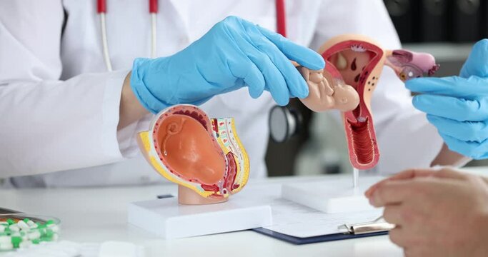 The doctor shows the model of the uterus