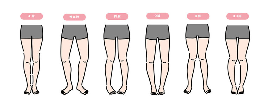 矯正が必要な女性の脚のセット