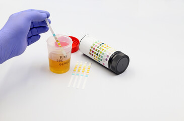 Hand of a doctor or scientist with a blue glove, introducing a test strip into a urine sample for...