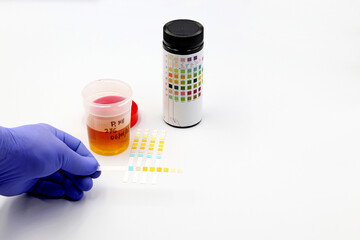 Hand of a scientist or doctor with a blue glove, examining a strip of urine test for the detection of inflammation, infections, type of diet, and other health parameters