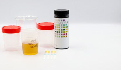 Test Strips for Urine analysis. For People on Alkaline Keto Diets and to Help Monitor Inflammation...