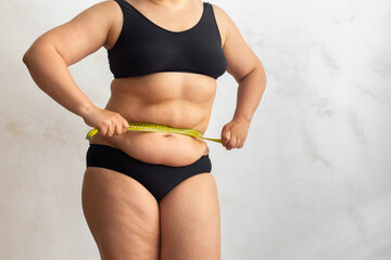 Cropped obese overweight woman with big cellulite sagging abdomen, measuring circumference of waist, belly with yellow roulette tape. Checking size before liposuction surgery. Show off adipose body