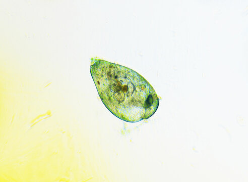Ciliates Stentor found in freshwater pond under the light microscope