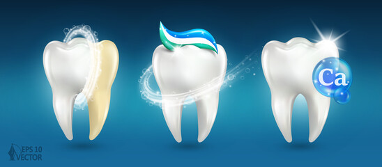 Set of dental white teeth, 3d models dental examination teeth, whitening and repair. Realistic vector illustration isolated on blue background