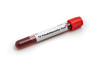 T3 Triiodothyronine Test Medical check up test tube with biological sample