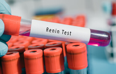 Kidneys Renin and angiotensin Test Controls blood pressure  both directly and also by regulating aldosterone production from the adrenal glands
